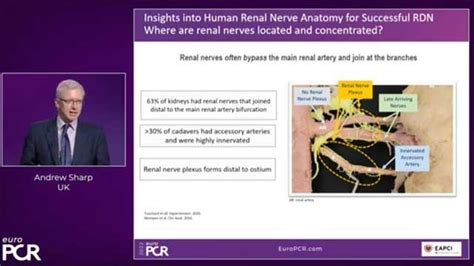 Advances in renal denervation: from patient selection to procedure