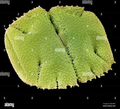 Cosmarium desmid. Scanning electron micrograph (SEM) of a Cosmarium species desmid green alga ...