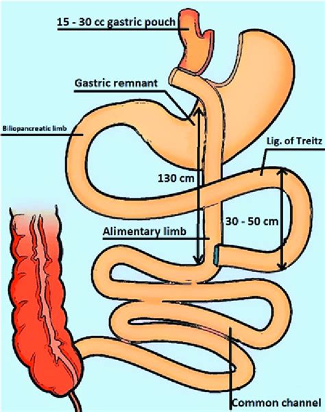 Ligament Of Treitz Anatomy