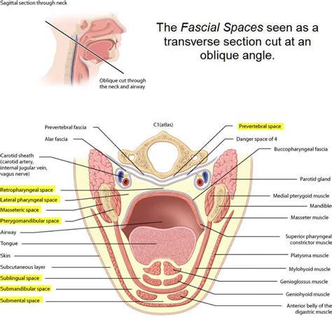 Cervico-Fascial Infection – Exodontia