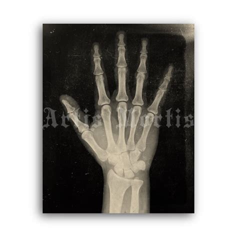 Printable X-Ray Human Hand - anatomy, medical radiology poster