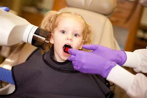 How Often Should Kids Get Dental X-Rays?