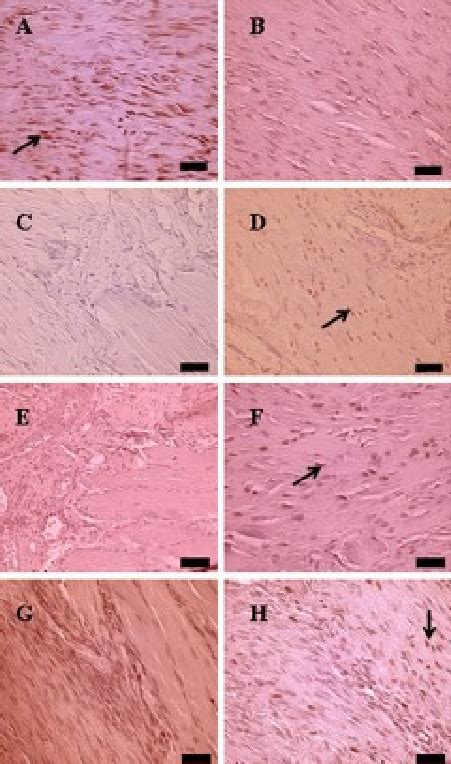 Histology of the longitudinal section of the Achilles tendon. The... | Download Scientific Diagram