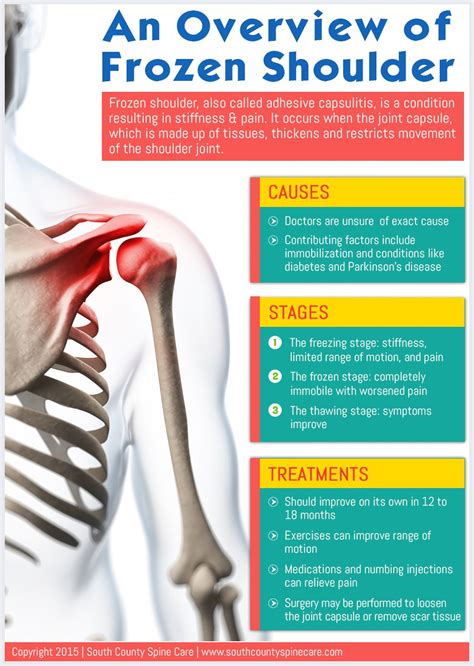 An Overview of Frozen Shoulder | Frozen shoulder, Shoulder surgery ...