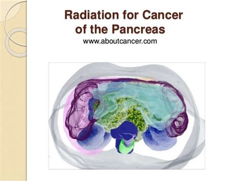 Radiation Therapy for Pancreas Cancer