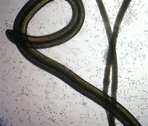 Research into tropical eye worm, Loa loa, yields new tests to rapidly ...