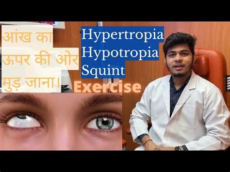 Hypertropia treatment exercises| Hypertropia and hypotropia | Squint eye exercises| eye ...