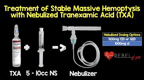 Inhaled TXA for Hemoptysis: Expanding Treatment Options