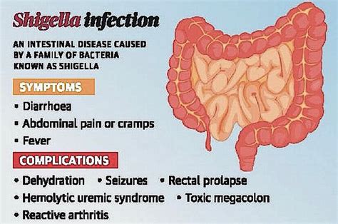 Complications of Shigella Infection | Marler Clark