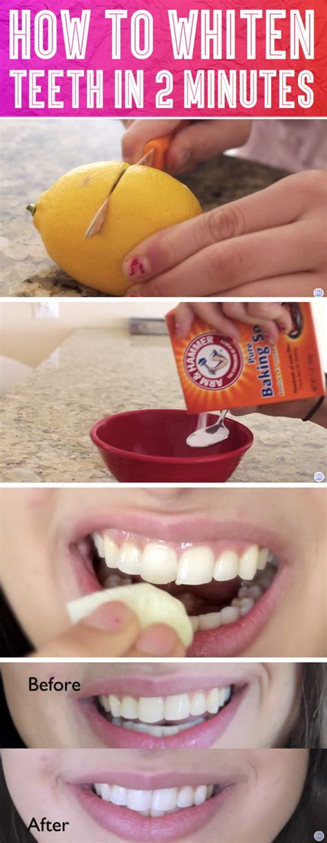 15 Natural Ways to Whiten Your Teeth: Homemade Teeth Whiteners - Just ...