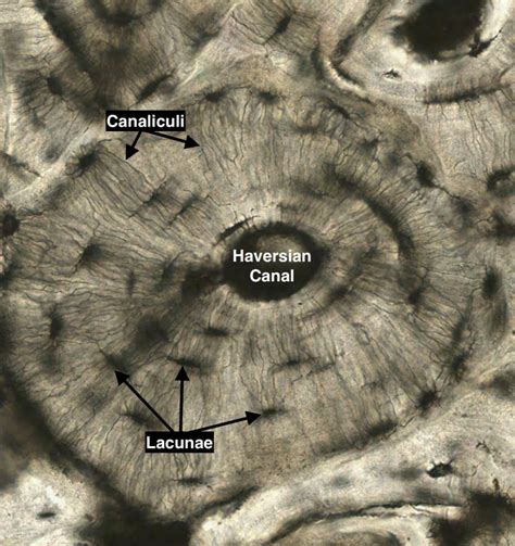 Compact Bone Histology Slide Labeled | My XXX Hot Girl