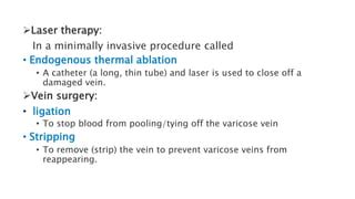 Varicose Vein.pptx | Free Download