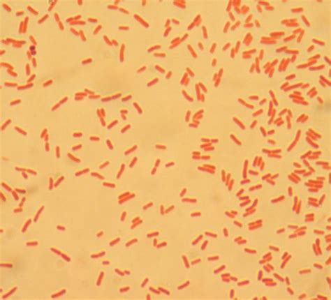 Photoblog: Introduction of Escherichia Coli - @364