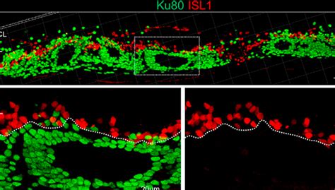 Improved retinal transplant technique almost ready for clinical trials | RIKEN