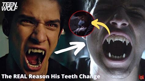 The REAL Reason Scott McCall's Teeth Change On Teen Wolf - YouTube