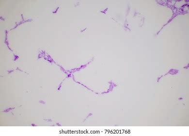 Spirillum Microscope Slide Royalty-Free Images, Stock Photos & Pictures | Shutterstock