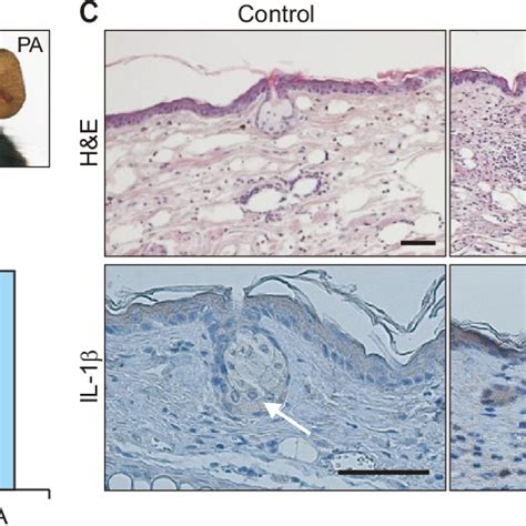 Induction of inflammation and interleukin (IL)-1β expression in the ...