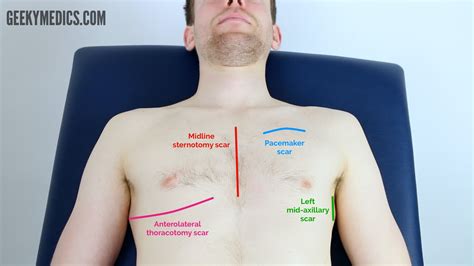 Respiratory Examination - OSCE Guide | Geeky Medics