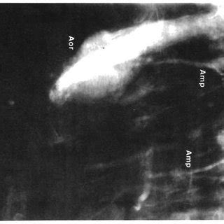 X-radiograph of sediment core at Stn 59-123 showing infaunal ...