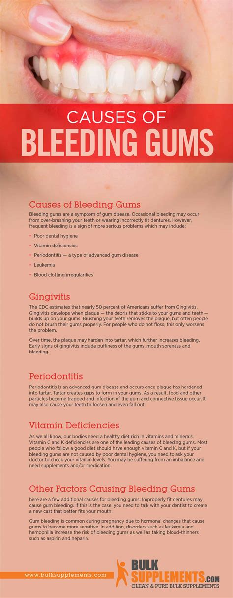 Bleeding Gums: Characteristics, Causes & Treatment