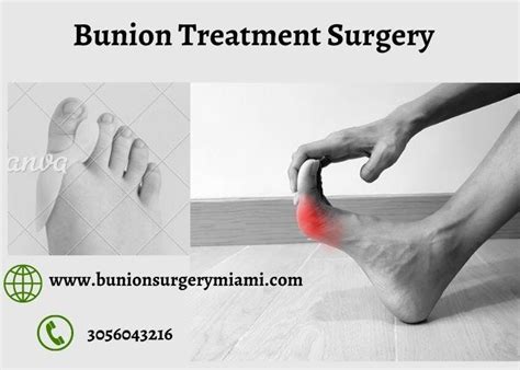 Bunion Treatment Surgery in Miami - Bunion Surgery Miami - Medium