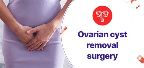 Ovarian Cyst Removal Surgery In Hyderabad: What to expect - Gmoney.in