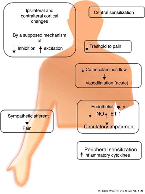 Complex regional pain syndrome (CRPS), a review | Medicina Universitaria