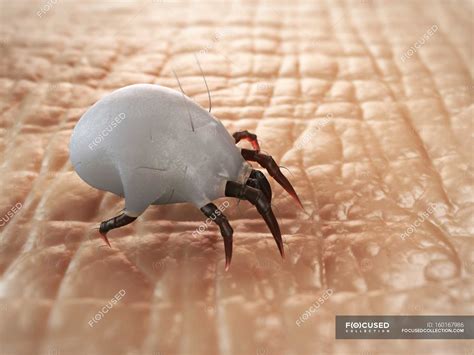 House dust mite on human skin — computer, close up - Stock Photo | #160167986