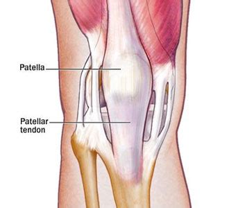 Patella Fractures (Broken Kneecap) of the Knee | Knee Specialist in Mumbai | Dr. Amyn Rajani