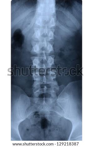 Tailbone Stock Photos, Images, & Pictures | Shutterstock