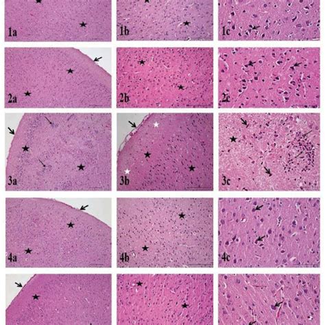 Fetal brain histology. 1a) C group. Pia mater (arrow), neurons and ...