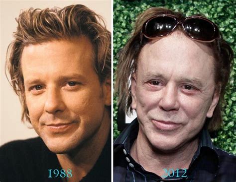 Mickey Rourke Plastic Surgery Before And After | Mickey rourke plastic ...