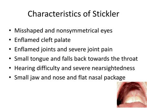 PPT - Stickler Syndrome PowerPoint Presentation, free download - ID:2030875