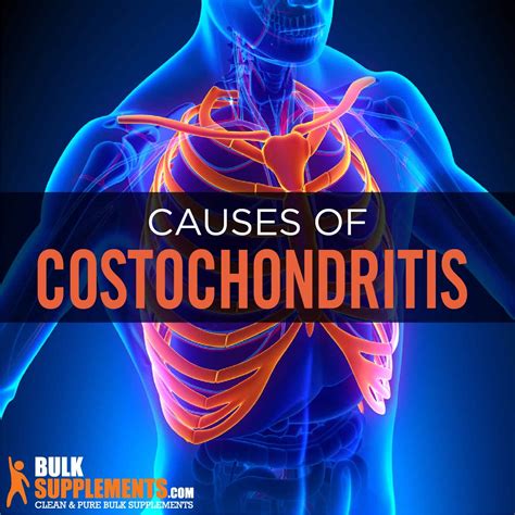 Costochondritis. Stop Chest Pain & Inflammation. Use Supplements.