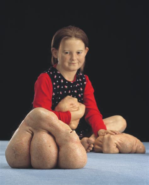 Patricia Piccinini: We Are Family, 2003