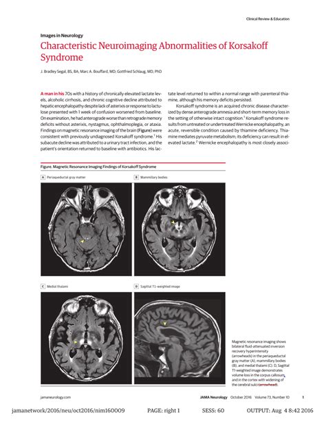 (PDF) Characteristic Neuroimaging Abnormalities of Korsakoff Syndrome