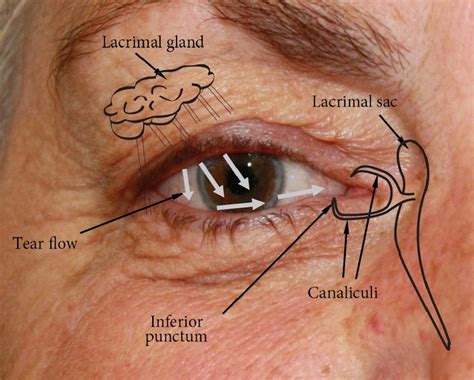 Socket anatomy - New Zealand Prosthetic Eye Service