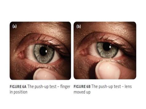 Fitting assessment of various contact lenses