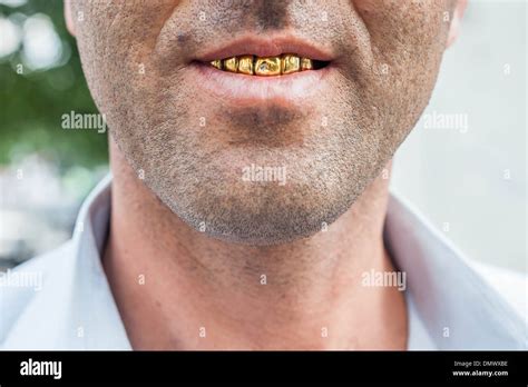 Gold Teeth Stock Photos & Gold Teeth Stock Images - Alamy