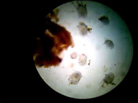 Otodectes cynotis microscope (ear mites) - YouTube