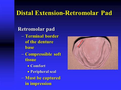 Retromolar Pad Anatomy