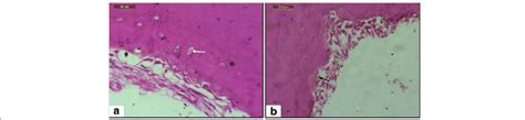 Light microscope view of different types of cementum in the repair ...