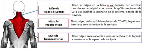 Músculo trapecio | Dolopedia