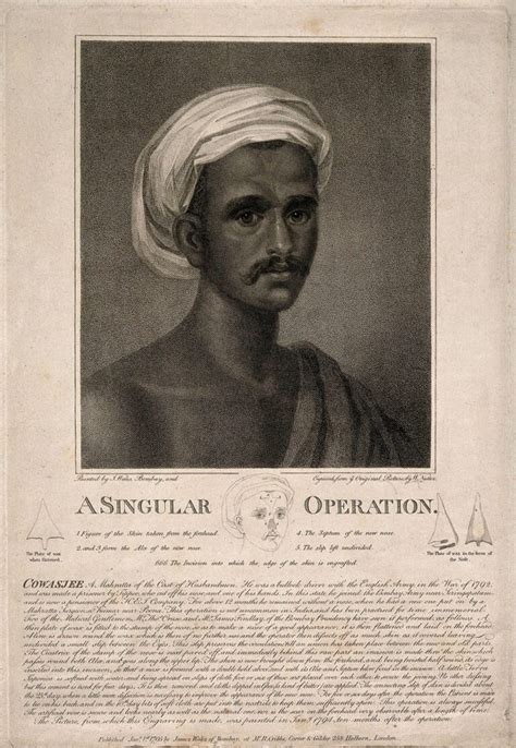 Sushruta, the father of rhinoplasty - Hektoen International