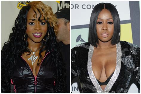 Remy Ma Before and After Plastic Surgery: Watch Her Transform Over Time!