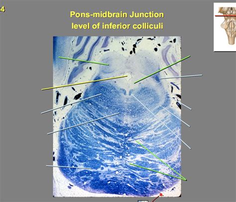 Pons-midbrain junction (inferior colliculi) Diagram | Quizlet