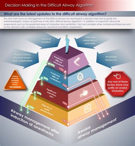 2022 Difficult Airway Guidelines – Singapore Society of Anaesthesiologists