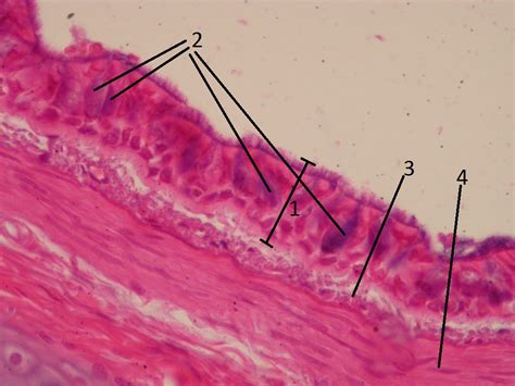 Bronchus (histology) - WikiLectures