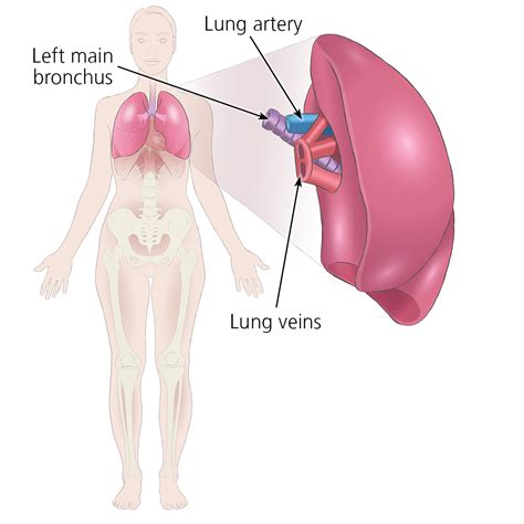 Lung transplant surgery - Organ transplantation - NHS Blood and Transplant