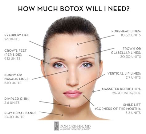 Printable Botox Injection Face Map